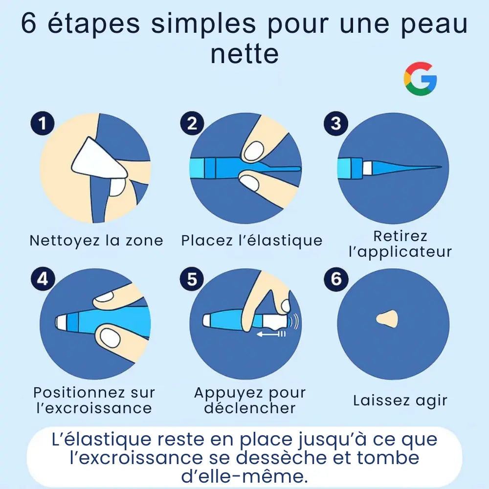 Kit Anti-Excroissances – Solution Rapide & Indolore